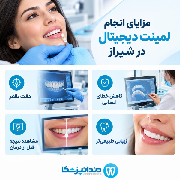 مزایای انجام لمینت دیجیتال در شیراز