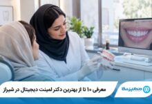 بهترین دکتر لمینت دیجیتال در شیراز