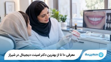 بهترین دکتر لمینت دیجیتال در شیراز