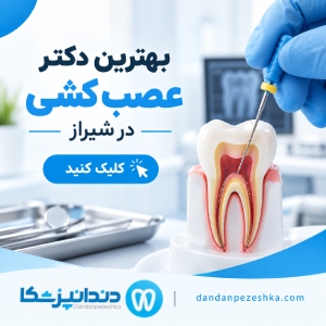 بهترین دکتر عصب کشی در شیراز