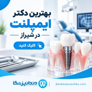 بهترین دکتر ایمپلنت در شیراز