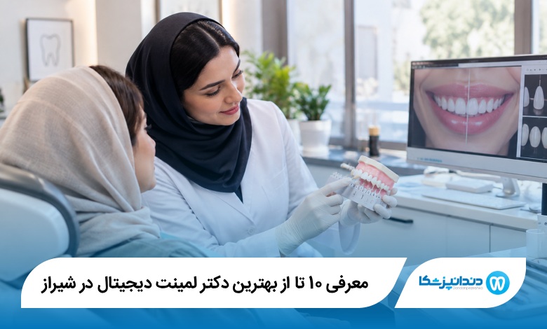 بهترین دکتر لمینت دیجیتال در شیراز
