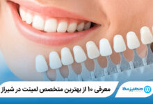 بهترین متخصص لمینت در شیراز