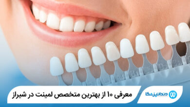 بهترین متخصص لمینت در شیراز