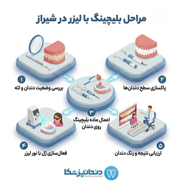 از کجا بهترین دکتر بلیچینگ در شیراز را تشخیص دهیم؟