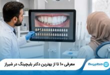 بهترین دکتر بلیچینگ در شیراز