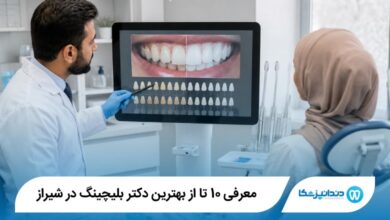 بهترین دکتر بلیچینگ در شیراز