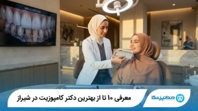بهترین دکتر کامپوزیت در شیراز