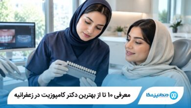بهترین دکتر کامپوزیت در زعفرانیه