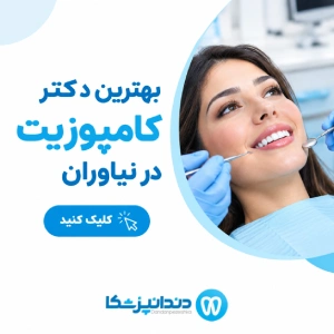 بهترین دکتر کامپوزیت در نیاوران