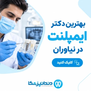بهترین دکتر ایمپلنت در نیاوران