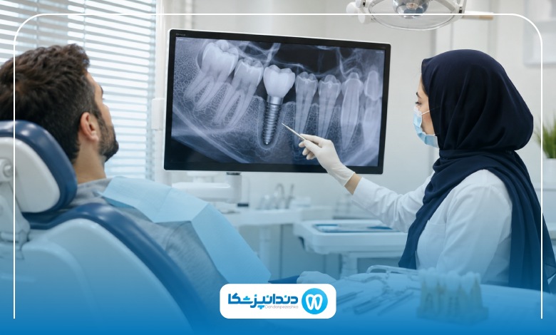 بهترین برند ایمپلنت دندان در سال ۱۴۰۵ کدام است؟