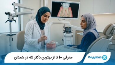 بهترین دکتر لثه در همدان