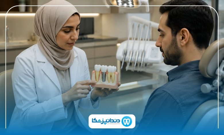 جدیدترین روش کاشت ایمپلنت در رشت