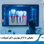 معرفی 10 تا از بهترین دکتر ایمپلنت در رشت【سال1405】✅