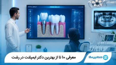 بهترین دکتر ایمپلنت در رشت