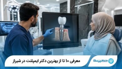 بهترین دکتر ایمپلنت در شیراز