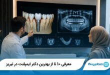 بهترین دکتر ایمپلنت در تبریز
