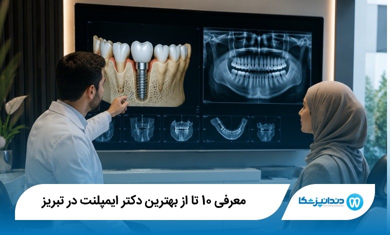 بهترین دکتر ایمپلنت در تبریز