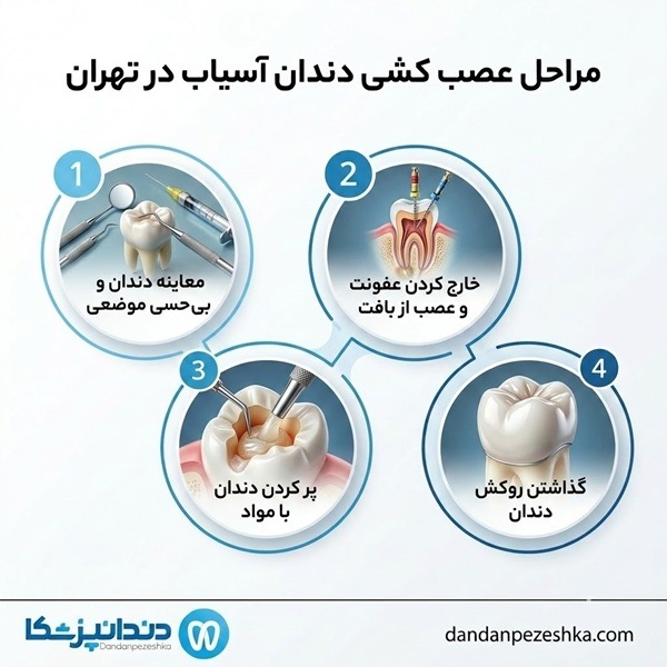 مراحل عصب کشی دندان آسیاب در تهران