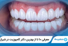 بهترین دکتر کامپوزیت در شیراز