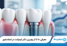 بهترین دکتر ایمپلنت در اسلامشهر