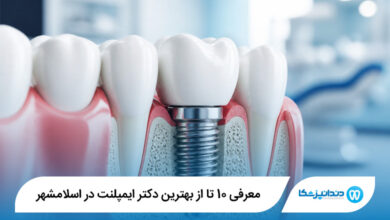 بهترین دکتر ایمپلنت در اسلامشهر