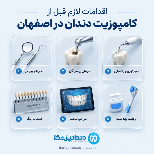 اقدامات لازم قبل از کامپوزیت دندان در اصفهان