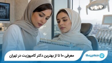 بهترین دکتر کامپوزیت در تهران