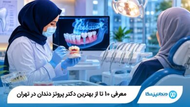 بهترین دکتر پروتز دندان در تهران
