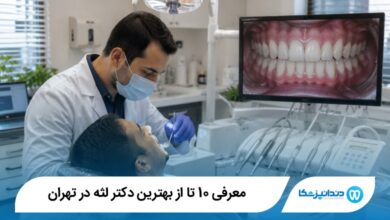 بهترین دکتر لثه در تهران