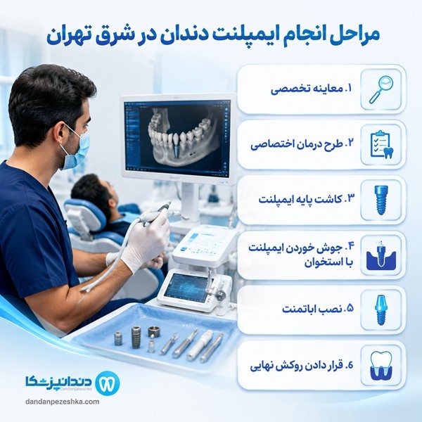 مراحل انجام ایمپلنت دندان در شرق تهران