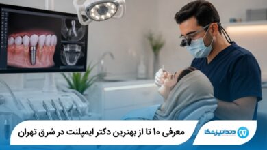 بهترین دکتر ایمپلنت در شرق تهران