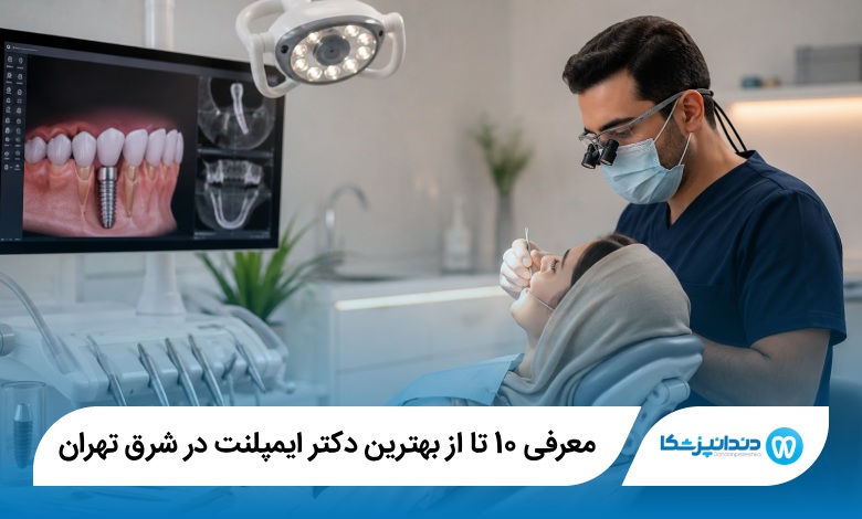 بهترین دکتر ایمپلنت در شرق تهران