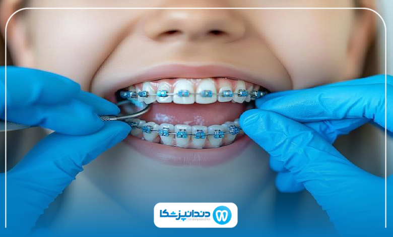 بهترین دکتر ارتودنسی در گرگان 