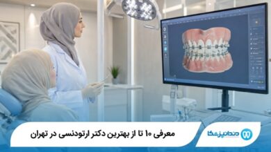 بهترین دکتر ارتودنسی در تهران