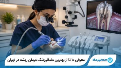 بهترین دندانپزشک درمان ریشه در تهران