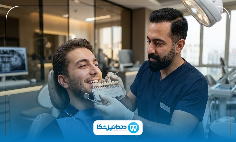 راهنمای کامل لمینت سرامیکی+ تفاوت‌ها و کاربردها