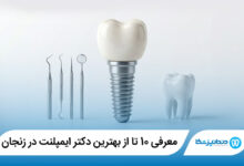 بهترین دکتر ایمپلنت در زنجان