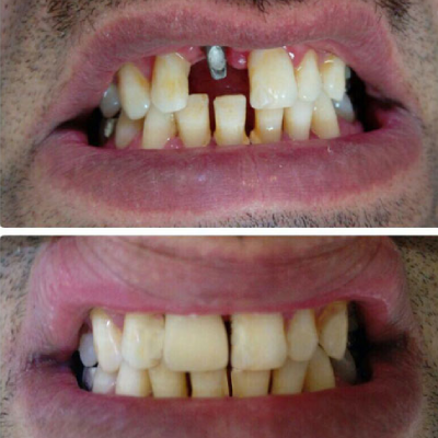 دکتر علی البرزی جهرمی