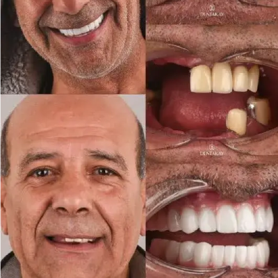 دکتر علی البرزی جهرمی