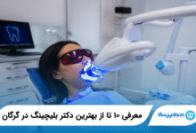 بهترین دکتر بلیچینگ در گرگان