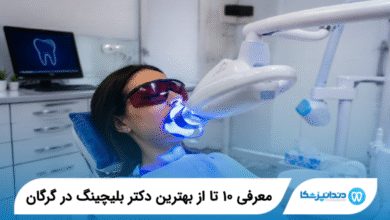 بهترین دکتر بلیچینگ در گرگان