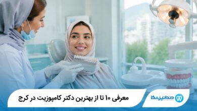 بهترین دکتر کامپوزیت در کرج