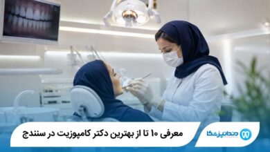 بهترین دکتر کامپوزیت در سنندج