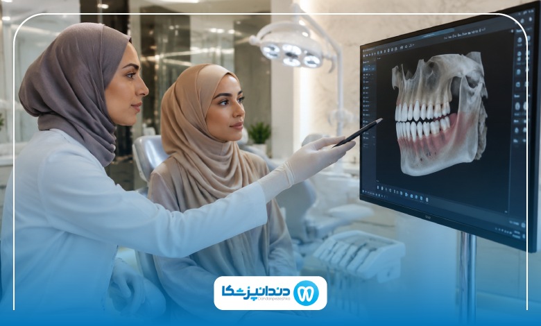 بهترین زمان کشیدن دندان عقل چه موقع است؟