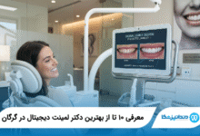 بهترین دکتر لمینت دیجیتال در گرگان