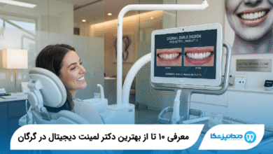 بهترین دکتر لمینت دیجیتال در گرگان
