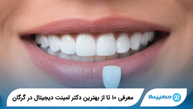 بهترین دکتر لمینت دیجیتال در گرگان