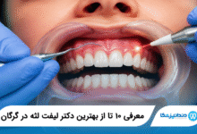 بهترین دکتر لیفت لثه در گرگان